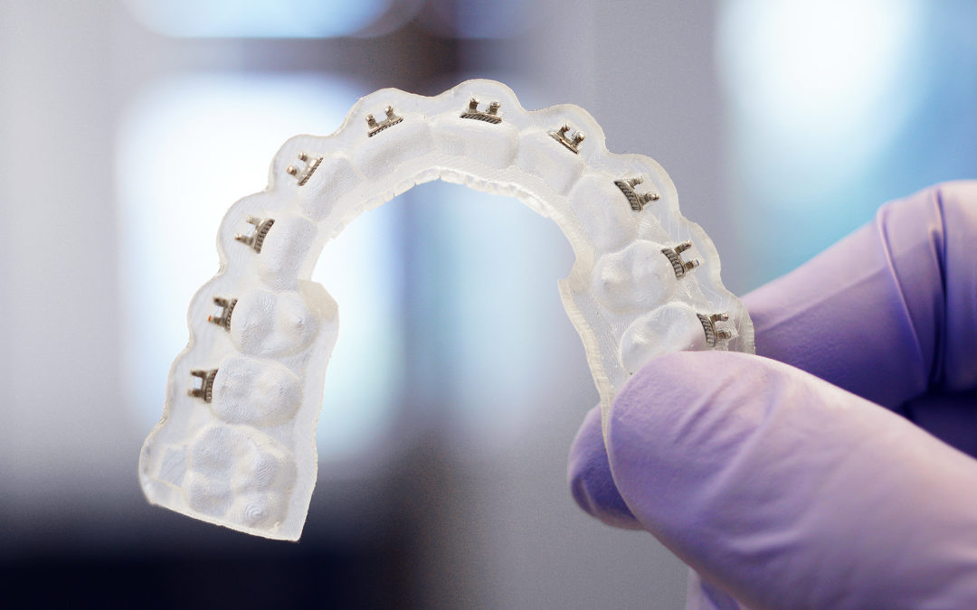 Dentist holding DLP 3D printed retainer in hands.